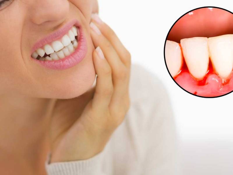 Effective Strategies for Oral Health to Treat Gum Infections